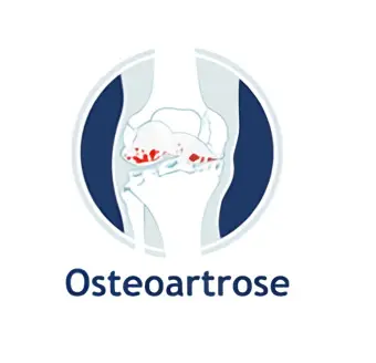 Logo site osteoartrose